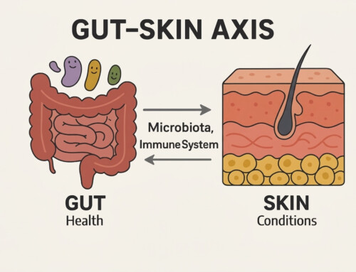 The Gut-Skin Axis: Why Your Topical Creams Aren’t Clearing Your Eczema